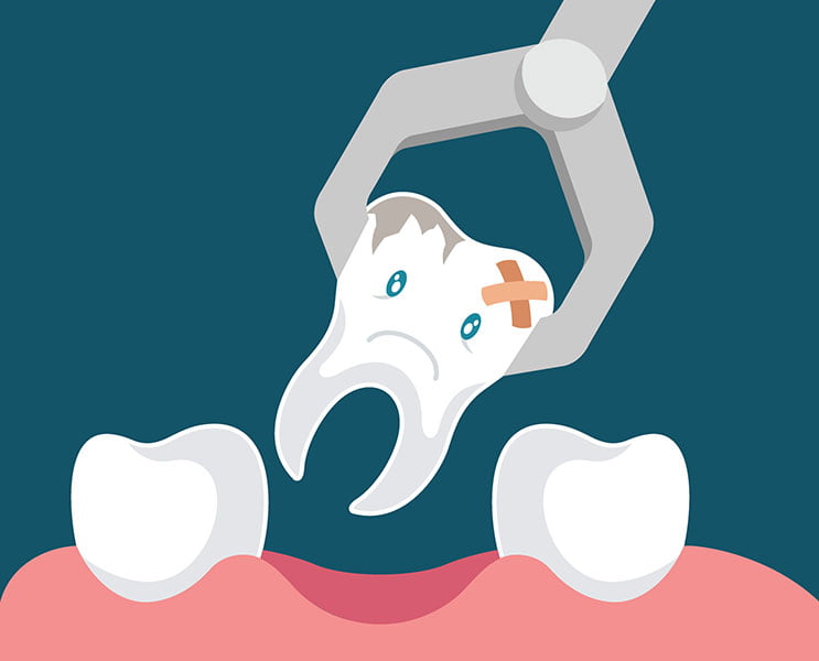 dental extraction cartoon